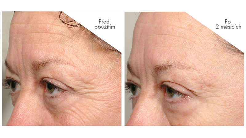 Síla anti-age péče inspirovaná časem 